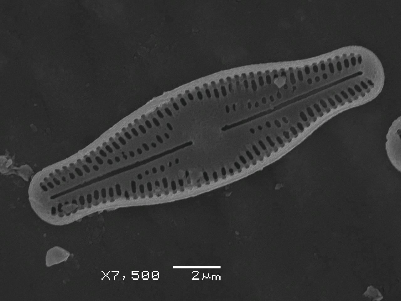 Представитель Семейства Diadesmidaceae